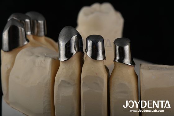 Localizador de aço Aplicações dentárias, Aplicações dentárias parciais de precisão Removíveis