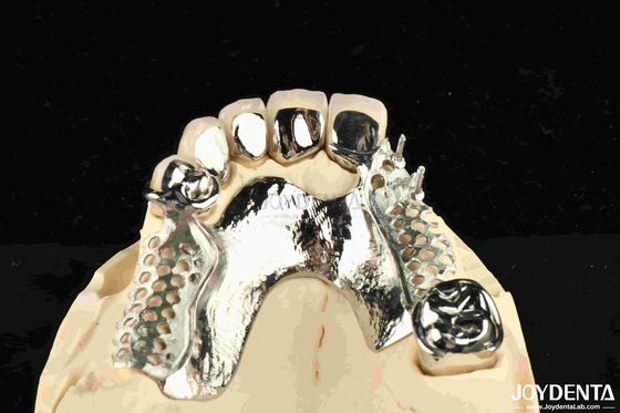 Quadro Dental de Ligação de Metal Removível Usável Para Dentistas