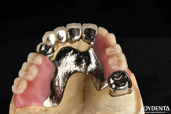 Estrutura dental estável Dentes concebidos