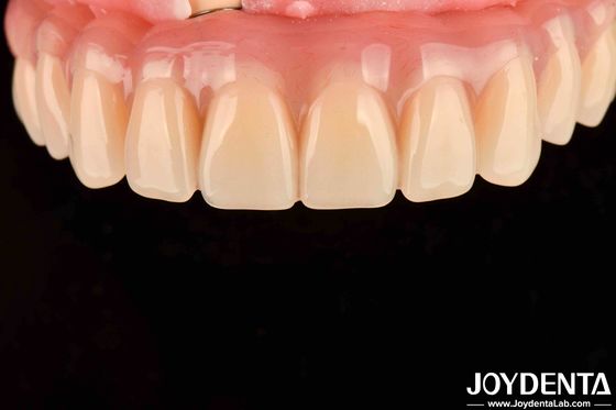 Tratamento Dental Alta Elasticidade Dentes falsos acrílicos Finish Para arranjo dentário