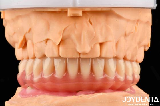 Dentadura natural de aparência acrílica finaliza alta biocompatibilidade com tecnologia de arranjo dentário