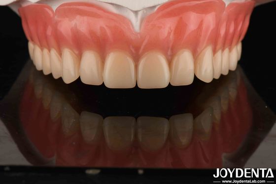 Dentes acrílicos Material de resina leve Restaurações dentárias Arranjo dentário