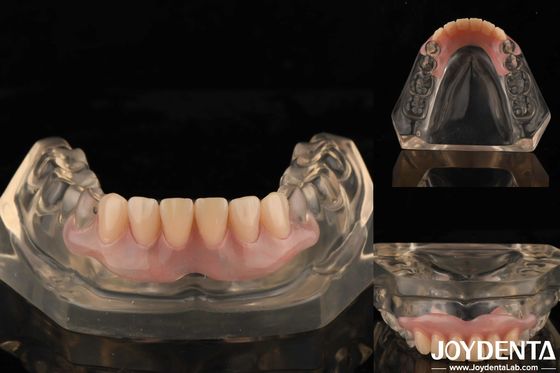 Tecnologia de arranjo dentário Flexível Dentura Finish Alta Elasticidade Personalização