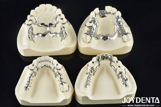 Estrutura dentária de design removível para caber na boca que suporta a mastigação