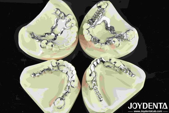 Quadro de metal de boa adequação dentária Material metálico para restaurações dentárias duradouras