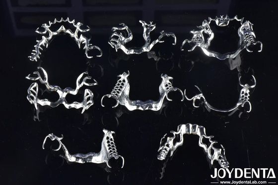 Laboratório Dentário de Quadro Removível de Apoio à Mastigação Com Suplementos de Metal de Ligação