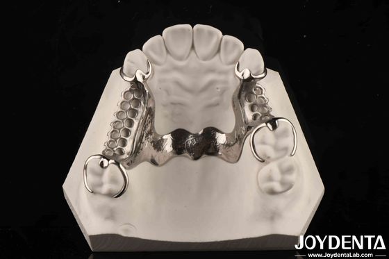 Prática Clínica Quadro Dental de Ligação de Metal