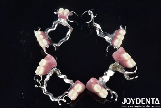 Estrutura personalizada de acabamento de dentes para aplicações dentárias