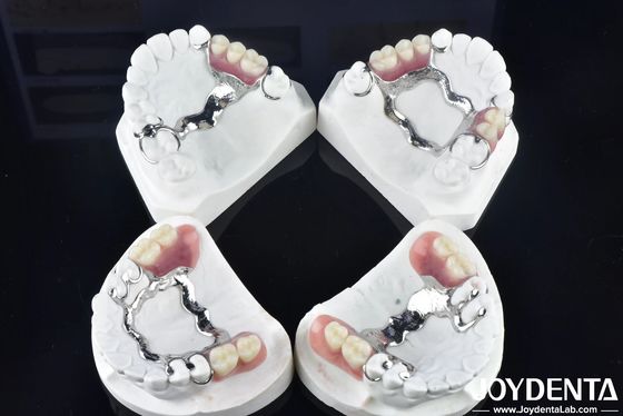 Elaborar um quadro tecnológico para o acabamento dos dentes para uma estrutura oral estável