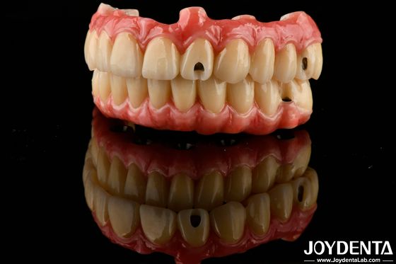 Excelente Elasticidade Dental Prótese Dental Acrílica Finish com Propriedade de Peso Leve