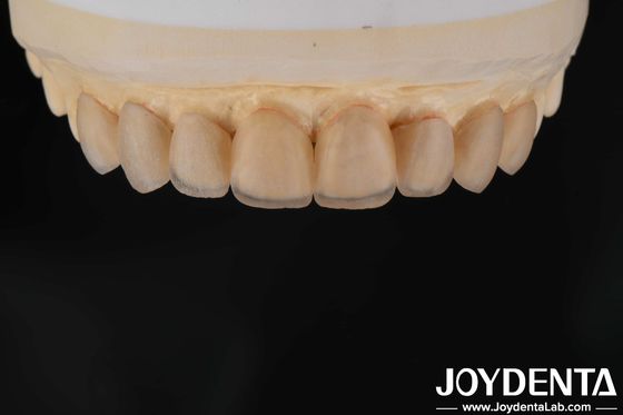 Aparência natural Finetes de vidro cerâmicos, Finetes de clínica dentária Ligação forte
