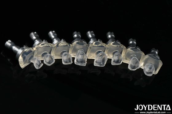 Vinil de vidro de porcelana de alta translúcido Veneers de dentes de alta resistência 0,3-0,8 mm espessura