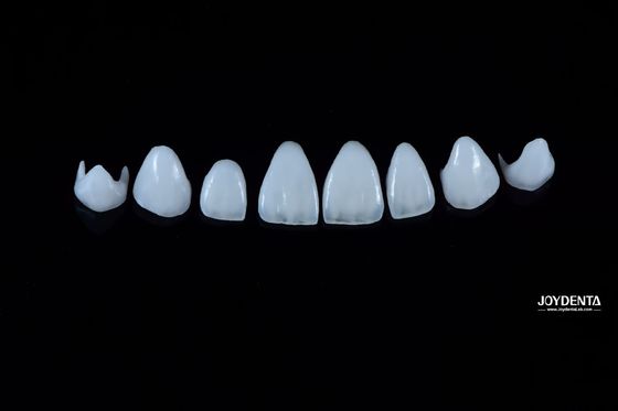 0.3-0.5mm Porcelana natural espessa Veneers Emax Alta resistência duradoura para a estética