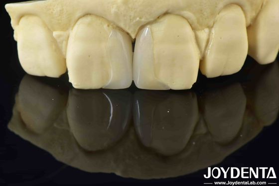 Folheados finos e suaves, personalizáveis e duradouros