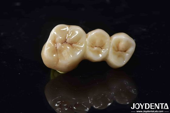 Alta biocompatibilidade Coroa de contorno completo de zircônio