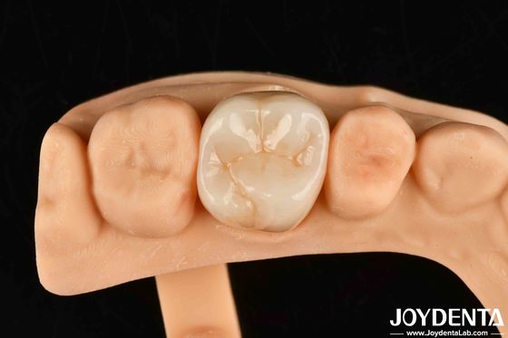 Alta resistência ao desgaste Dental Full Zirconia High Strength Full Contour Zirconia Bridge