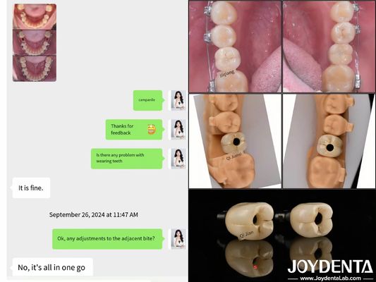 Implantes Dentários de Arco Completo de Longa Duração Implantes Endossais Comprimento 10mm-16mm