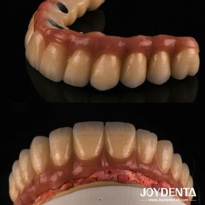 Forja e moagem PFM coroa dentária, restaurações dentárias porcelana coroa de metal fundido