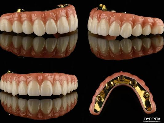 Ti Bar Zirconia Hybrid Implant Bridges Alta Translucidez Para Prótese Dental