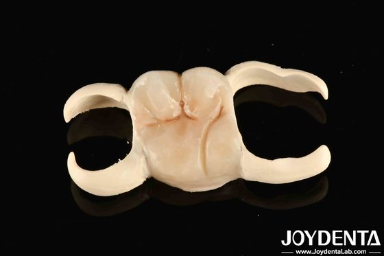 M75 Dureza PMMA Material Discos Dentários Resistentes a Riscos Para Sistemas CAD / CAM