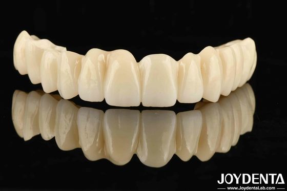 Desenho dentário de PMMA multicamadas com gradiente sem costura para transições naturais de sombra