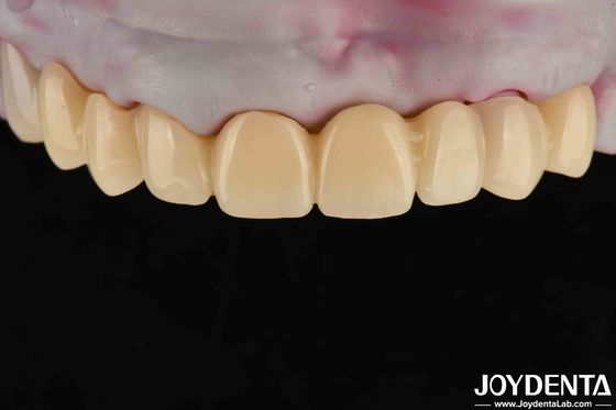 Alto Transparência PMMA Material Dental Cor Natural Estética realista