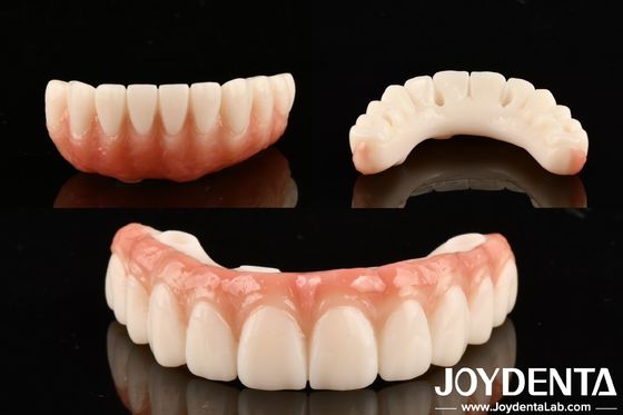 PMMA M75 Dental de Alta Transparência para Restaurações Estéticas e Resistentes a Riscos