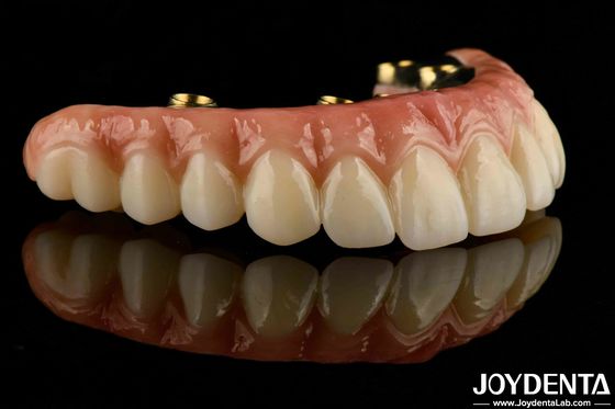 Ponte híbrida de zircônio para prótese dentária duradoura