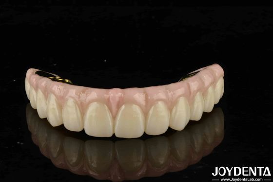 Alta Durabilidade Zirconia Solução Última Para Dentes Naturais e Gengiva Compatibilidade