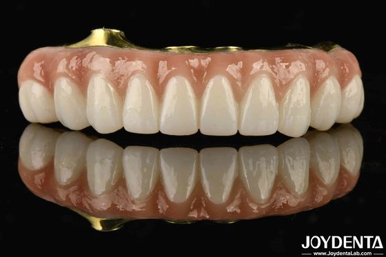 Titânio e zircônio conforto confortável para usar Ti-Bar zircônio ponte híbrida para substituição de dentes perdidos