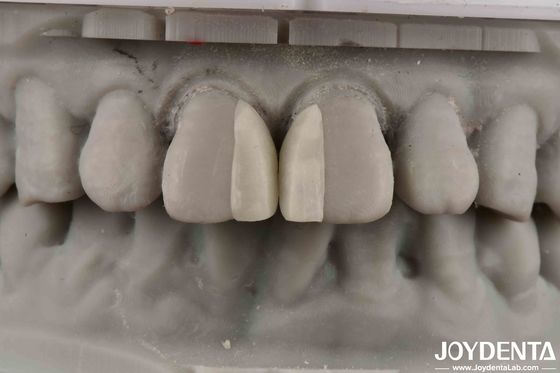 Superfícies curvas resistentes ao fogo Micro veneer para decoração de interiores