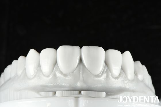 Cera Dental de Cor Natural Solução versátil para restauração de dentes únicos ou múltiplos