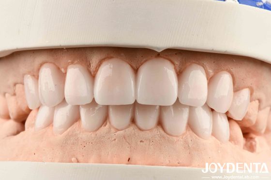 Materiais diversos e boa elasticidade no acabamento de dentaduras flexíveis para metais e resinas