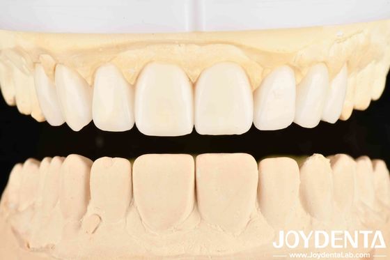 A boa elasticidade e a tecnologia de arranjo dos dentes da dentista