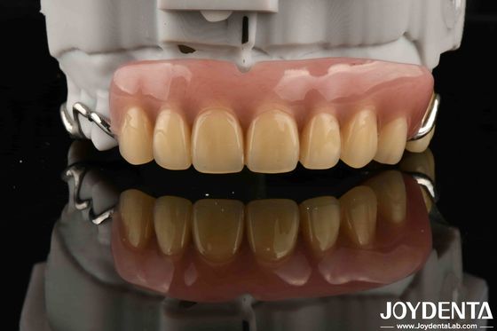 Elaborar estrutura dental oral estável estrutura estabelecer dentes acabamento para a saúde oral ideal