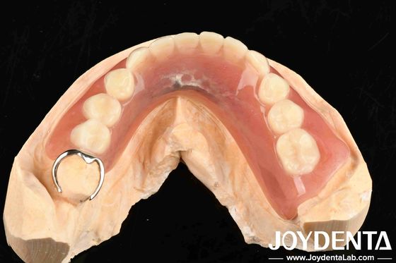 Metálicos e Resinas Estrutura Definição De Dentes Finish Para Estrutura Oral Estável Em Configuração Dental