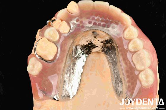 Quadro bonito e harmonioso Instalar acabamento de dentes para salas de tratamento dentário