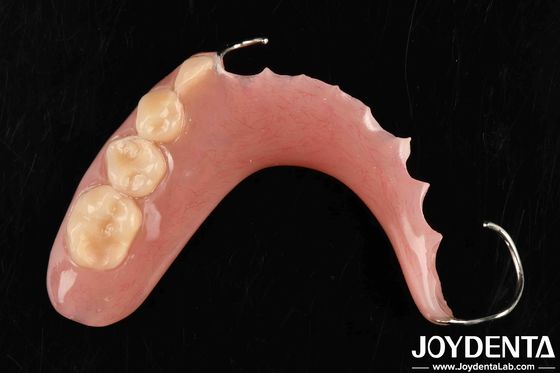 Desenvolver uma tecnologia para estrutura oral estável estrutura dentária de acabamento em aplicação dentária