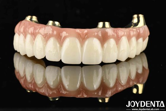 Funcionalidade Ti-Bar compatível com dentes e gengivas naturais restaura a função de mastigação