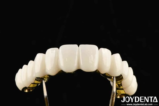 Fabricada sob medida, excelente resistência para soluções dentárias personalizadas.