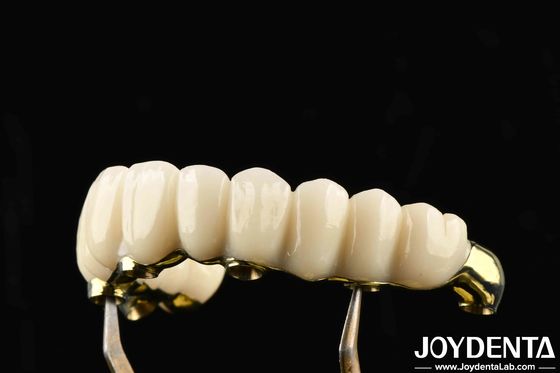 Confortável de usar Ti-Bar Zirconia Hybrid Bridge Restaura a função de mastigação Compatível com dentes e gengivas naturais