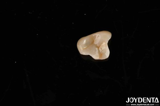 Materiais não tóxicos E-max Solução final Emax Inlay Onlay para normas de biocompatibilidade