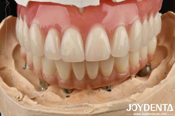 Boa Elasticidade Dental Prótese Dentária Acrílica Finish Com Tecnologia de Disposição Dental