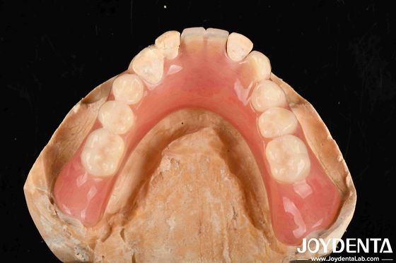 Peso leve Boa Biocompatibilidade Dentadura Acrílica Finaliza Personalização Personalizada Em Equipamentos Médicos