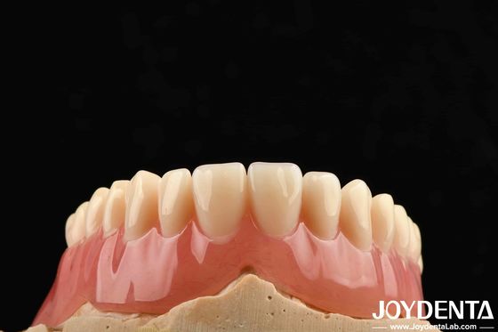 Boa Elasticidade Finitura de Dentadura Acrílica para Peso Leve Personalização Personalizada e Design Personalizado