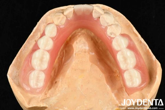 Material de resina variado e leve acabamento de dentadura acrílica