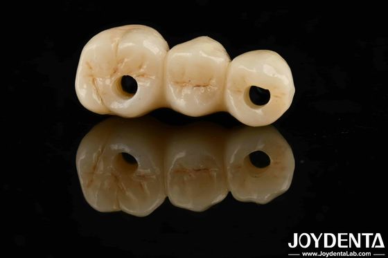 Alta estética Alta resistência flexural 1000 MPa Full Zirconia For Standards