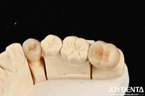 Excelente biocompatibilidade Zirconia completa com alta resistência à corrosão e resistência flexural de 1000 MPa
