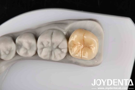 Alta resistência ao choque térmico e à corrosão Zirconia completa com excelente estabilidade química