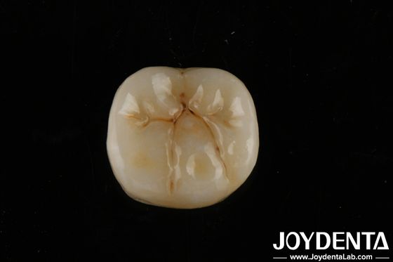 Alta translucidez Zirconia completa com camadas Biocompatibilidade e resistência flexural de 800 MPa